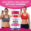 Vitaluxa Rapid Slim ACV Gummies, RapidSlim + ACV Gummies Dietary