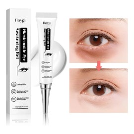 Niacinamide Eye Repair – Adiós Ojeras y Arrugas