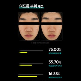 식스킨 여드름 뾰루지 피지 트러블 진정 고농축 기능성 세럼 피지스킵, 10g, 1개 Sixskin Acne Pimple Sebum Trouble Soothing High-Concentration Functional Serum, 10g, 1 piece