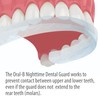 Oral-B Nighttime Dental Guard, Less Than 3-Minutes for Custom Teeth