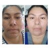 Crema Facial L2hcare Hidratante, Desmanchadora Y Antiarrugas