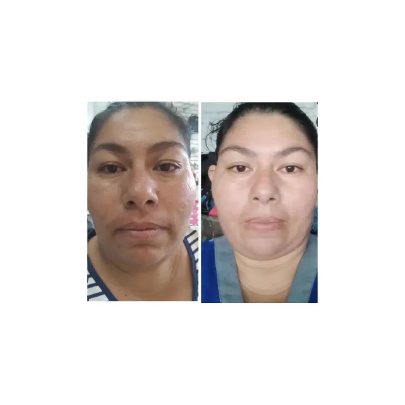 Crema Facial L2hcare Hidratante, Desmanchadora Y Antiarrugas