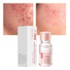 Acne Buster Loción Secante Con Ácido Salicílico 2pcs Todo Tipo
