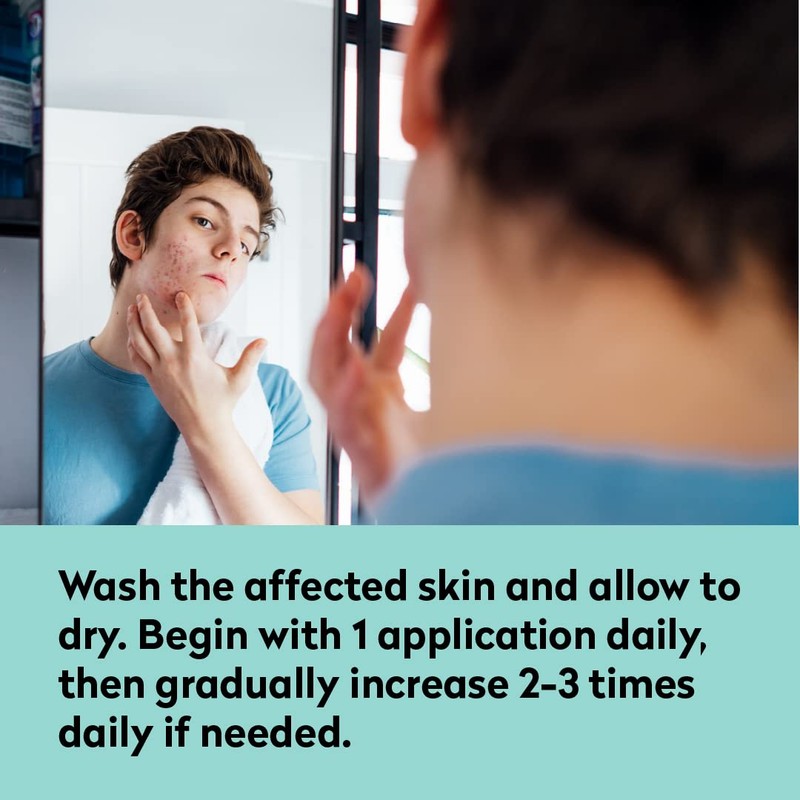 All Acne Treatment - Face and Body - Spot and