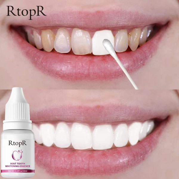 RtopR Teeth Whitening Essence-Plant Extracts-RtopR Whitening Essence-Teeth Whitening, Best Teeth Whitening Agent-Natural Whitening Essence