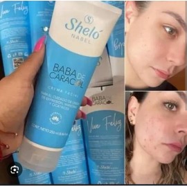 Olvídate De Manchas Las Líneas De Expresión Con Shelo Nabel