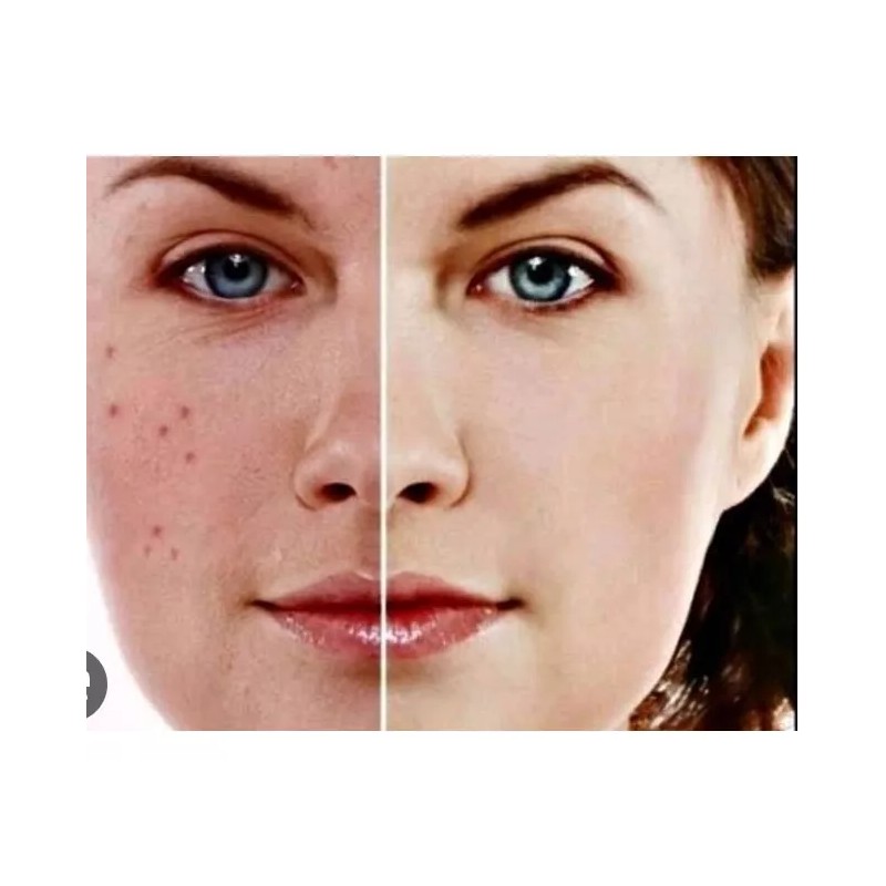 CAHNSAI Petalos De Rosa Mascarilla Humectante Aclarante Hidratacion