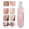 Ultrasonic Skin Scrubber Blackhead Pimple Removal Face Pore Vibration Cleanser