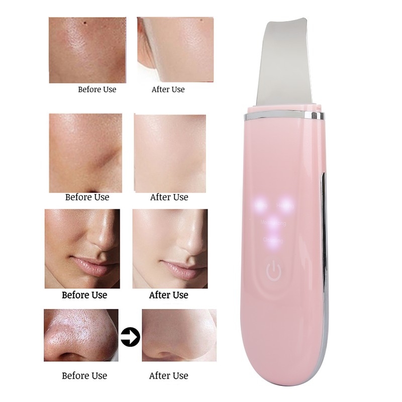 Ultrasonic Skin Scrubber Blackhead Pimple Removal Face Pore Vibration Cleanser