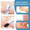 2Pcs Feet Scrubber, Efficient Foot Stone for Dead Skin Removal,Double