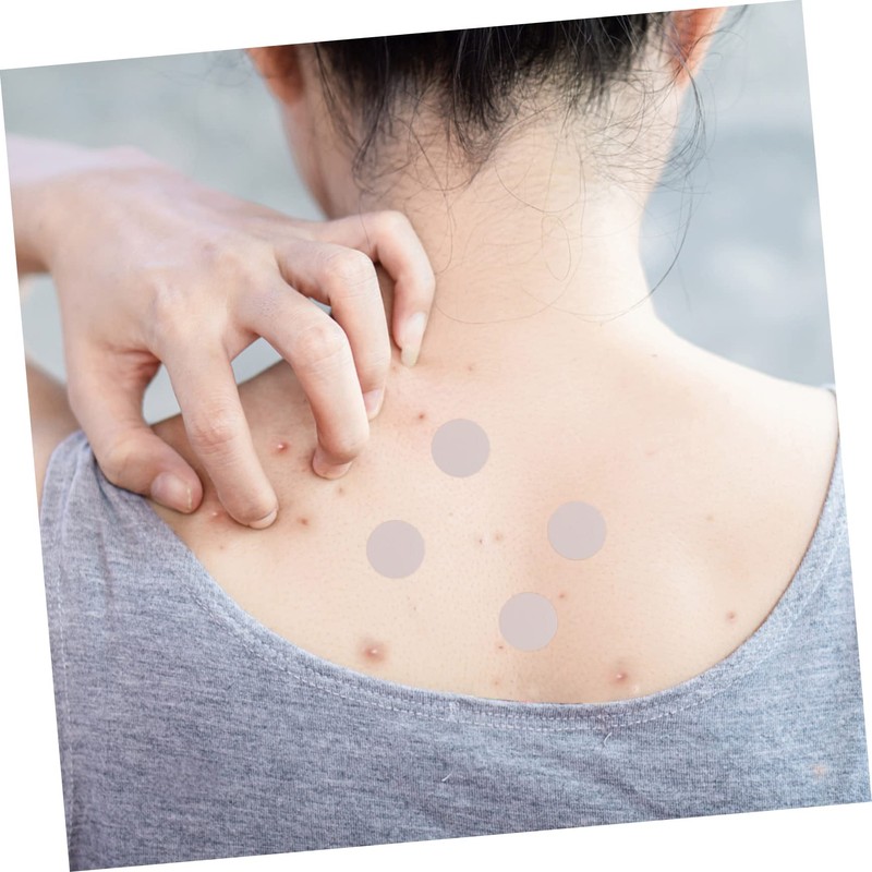 FOMIYES Pimple Patch 2pcs Treatment Waterproof Invisible Matte Face Healing