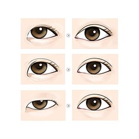 Eye Charm Queen Double Eyelid Tape 50 pairs by Eye Charm