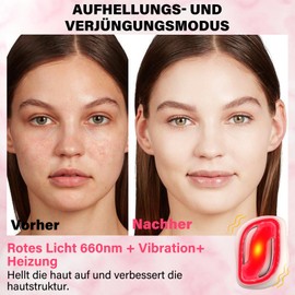 Face Massage Against Wrinkles EMS with Pink Quartz Jade Stone Massage Stones, Vibration and Heat, Face Lifting Device with LED Red Light Face Massager for Eye Swelling Skin Tightening of Face