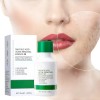 Tratamiento Antiacne Control Poros Manchas Espinillas 35ml