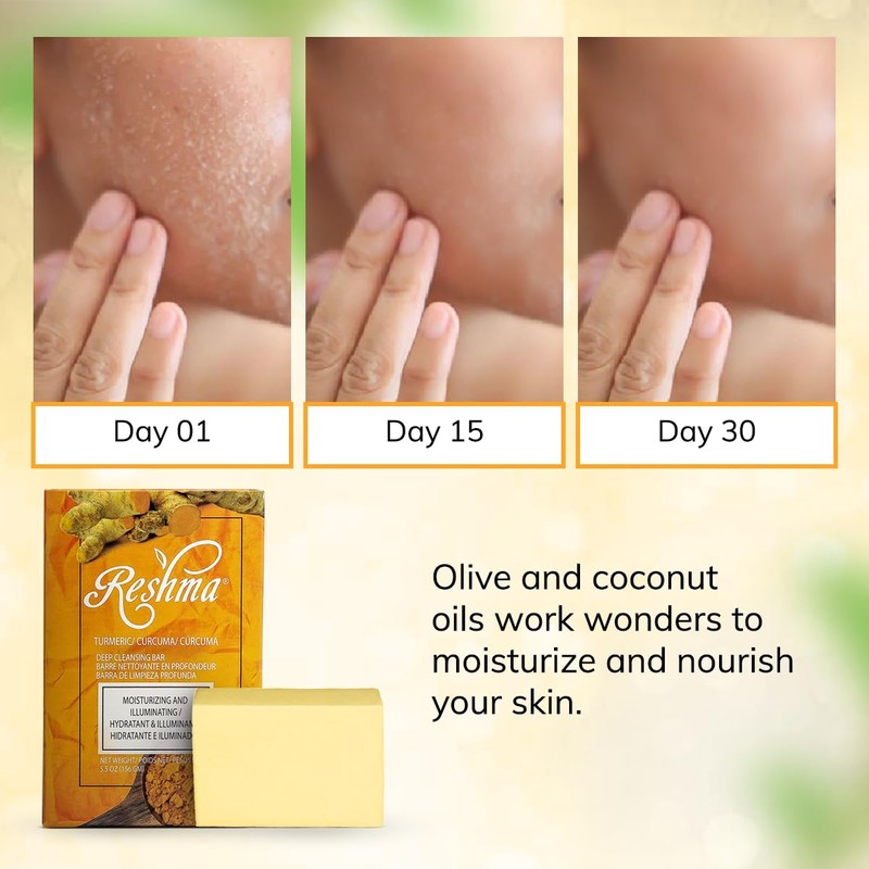 Reshma Beauty Turmeric Soap | Infused with Turmeric Extract, Olive