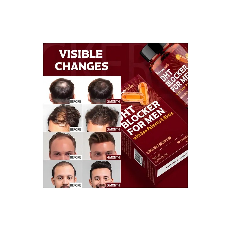 Vivaravida Bloqueador Dht Para Cabello 90 Cápsulas