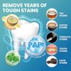 Professional Whitening Strips for Sensitive Teeth:Hydrogen Peroxide-Free Treatments - Effective