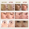 ABERA Melasma Cream (Premium Version) - Cream for Face Treatment,
