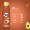 Pert Shampoo Café Aguacate Ayuda Reducir Caída Cabello Haciendo Que