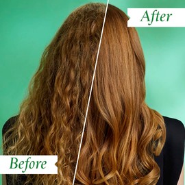 PHILIP KINGSLEY Flaky Scalp Flaky Scalp Calming Toner for Flaky Dry Oily Scalps Treatment, Scalp Care Products Soothing, Refreshes, Soothes, and Comforts The Scalp, 8.45 oz.