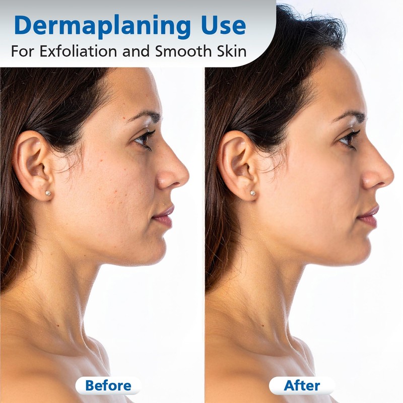 Swann Morton #10R Disposable Surgical Scalpel with Blade & Guard