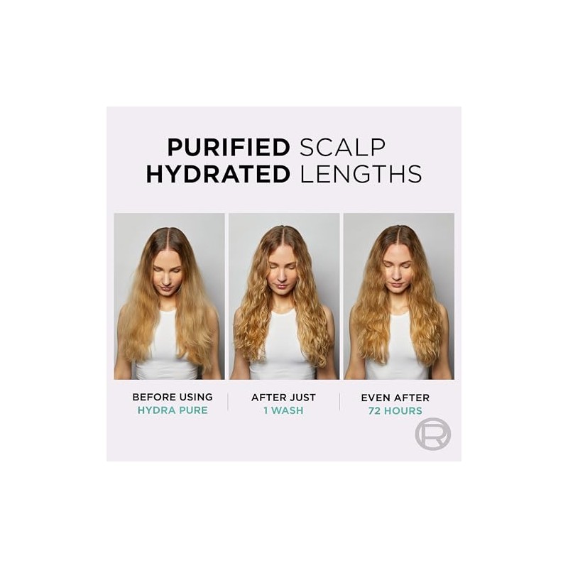 L’Oréal Paris Elvive Hydra Pure, Oil control Scalp serum, 102ml