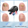 iKeener iKeener Nail Fungus Laser Therapy Device,Nail Laser Cleaning for
