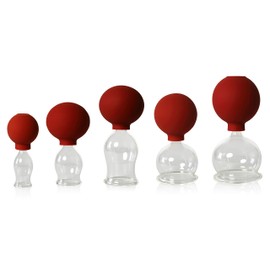 Lauschaer Glas 5er Schröpfglas-Set mit Ball 20-30-40-50-60mm zum professionellen, medizinischen,feuerlosen Schröpfen mundgeblasen, handgeformt, Schröpfglas, Schröpfgläser, Lauschaer Glas