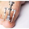 SJTR Corrector De Uñas Enterradas Pies Y Manos Encarnadas