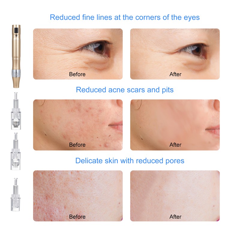 Electric Microcrystal Import Instrument Nano Needle Beauty Device Microcrystal Pen