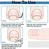 (30+2) Pack Ingrown Toenail Correction Treatment Kit, 30PCS Ingrown Toenails