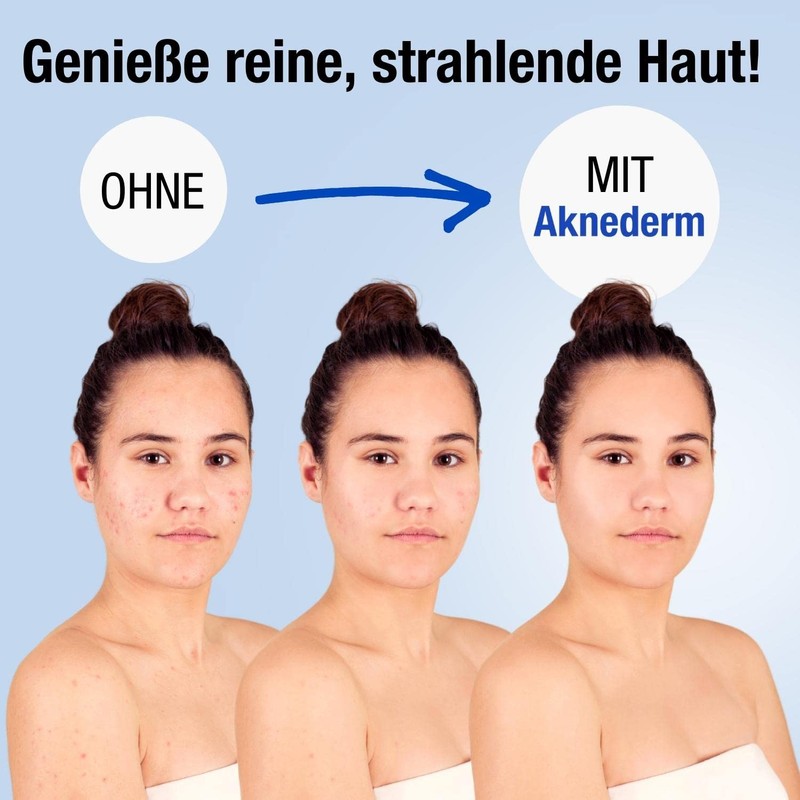 Aknederm Reinigungsschaum 150 ml