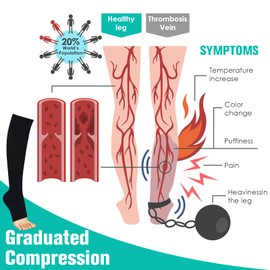 Bropite Calcetines de compresión de punta abierta para hombres y mujeres, 2 pares de calcetines de compresión médica de circulación sin dedos de 15 a 20 mmhg, Negro/Beige, S-M