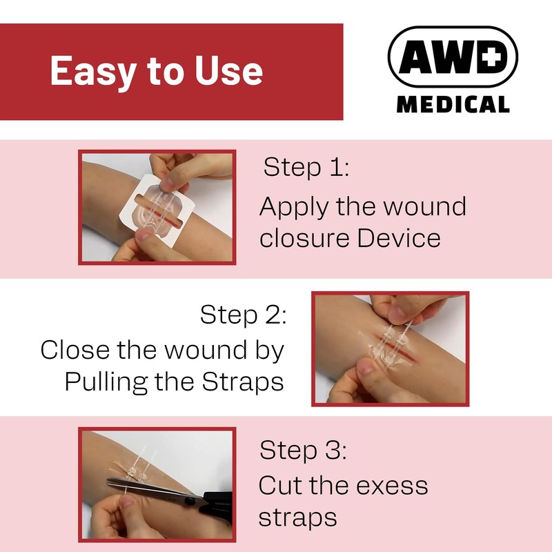 AWD Zip Stitch Wound Closure Strips - 2 Zipstitch Devices,