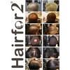 Hairfor2 Haarverdichtungsspray gegen lichtes Haar | Haarpuder | Streuhaar |