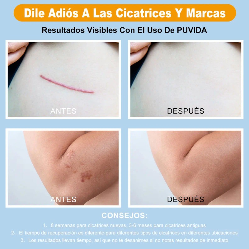 Crema Cicatricial Minimizar Reducir Cicatrices 20g