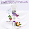 Dark Spot Remover Cream for Intimate Area: Dark Spots Corrector