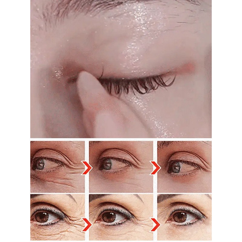 다크써클 아이패치 주름개선 미백 아이마스크팩 눈가 붓기완화/눈밑 지방제거/눈밑꺼짐 제거 Dark