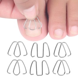 Gancho de Corrección de Uñas Herramienta para Uñas Encarnadas Tiras Correctoras de Uñas Elevador de Alambre Herramienta de Recuperación para Mujeres Hombres Corrector de Juanetes para Pedicura