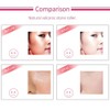 Portable Oil Absorbing Volcanic Face Roller Shrink Pores Oil Control