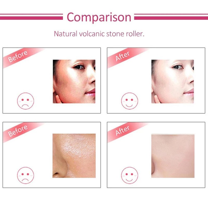 Portable Oil Absorbing Volcanic Face Roller Shrink Pores Oil Control