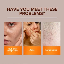 Turmeric Soap with Natural Ginger, Anti-Acne Face and Body Cleanser, 100g