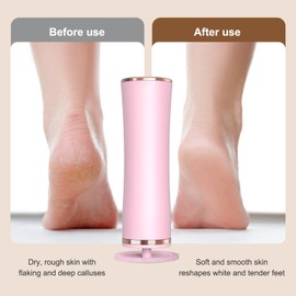 Foot Sander,Electric Foot File,Electric Foot File Hard Skin Remover Practical,Hard Skin Remover Foot Electric Adjustable Speed,Adjustable Speed,Suitable for Dry,Cracked Heel Calluses
