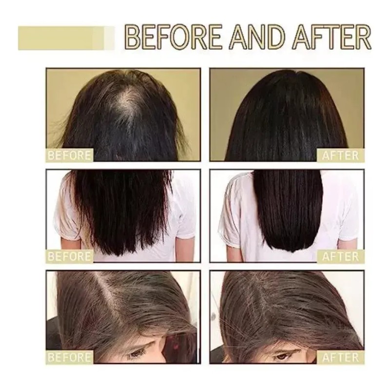 2pcs Aceite Esencial Para Cuidado Del Cabello Veganic Hair