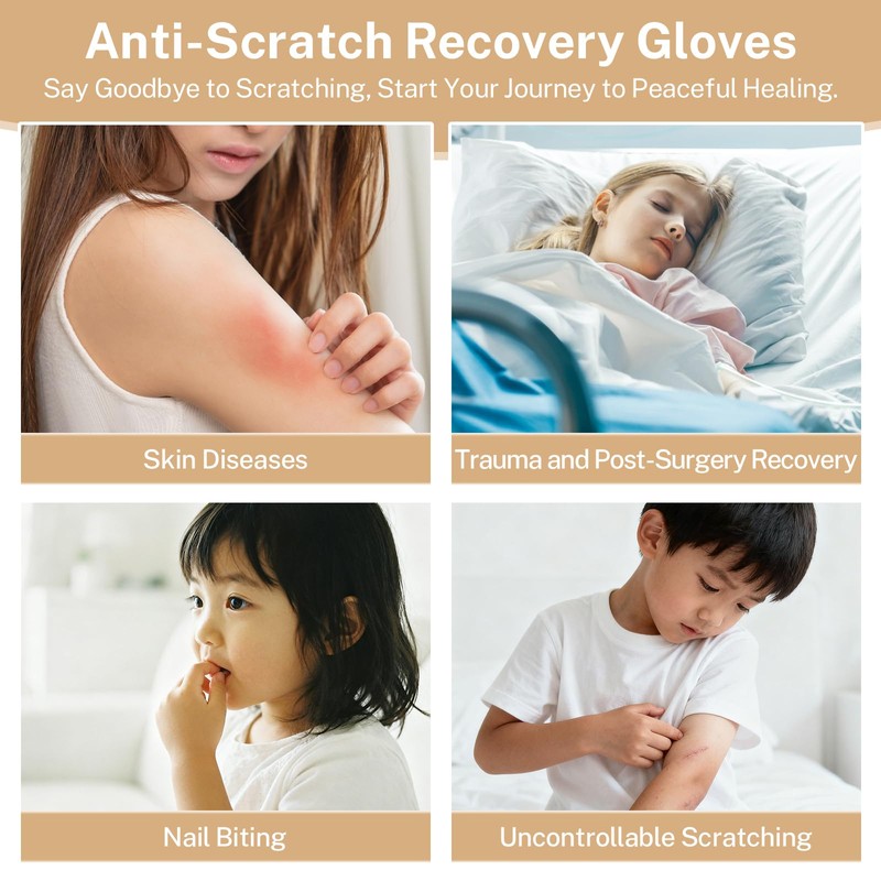 ANBANREY Anti-Scratch Mittens for Autism & Sensory Needs, Safety Restraint