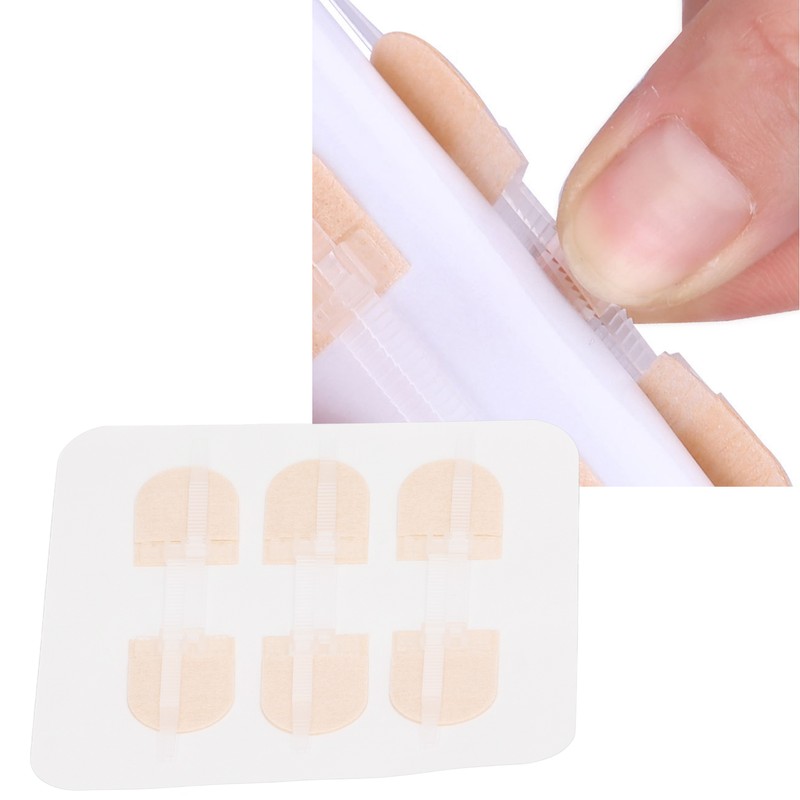 3 Strap Zipper Wound Closure Patches Breathable Seamless Elastic Zip