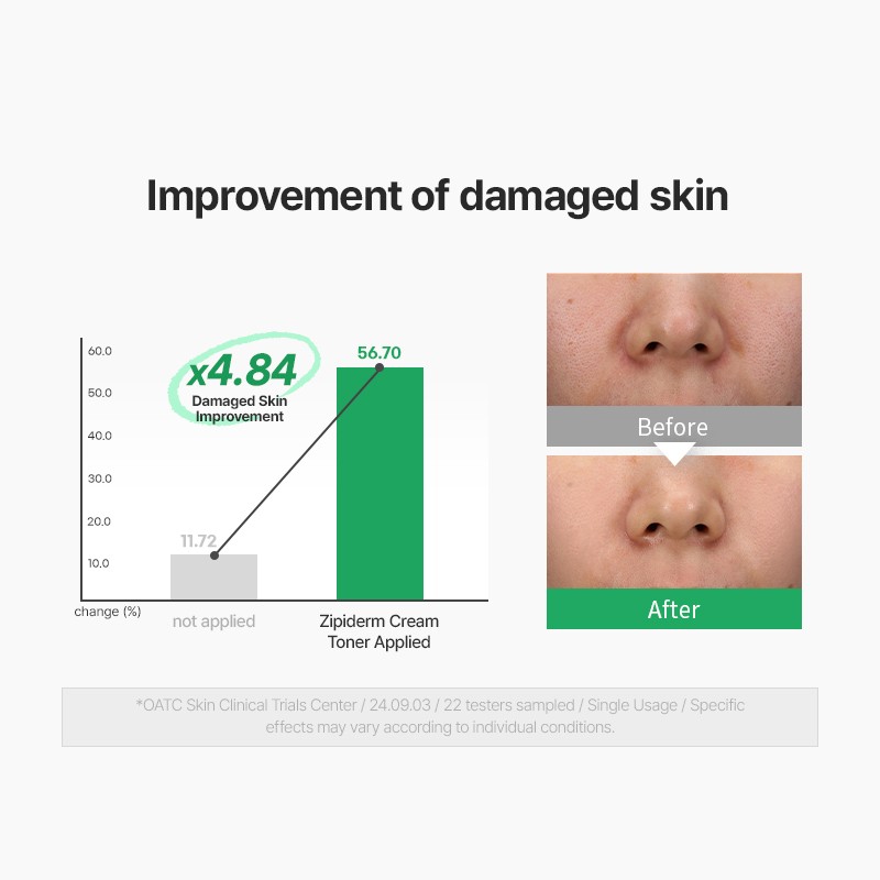 zipiderm [zipiderm]EGF Skin Barrier Cream Toner 150ml