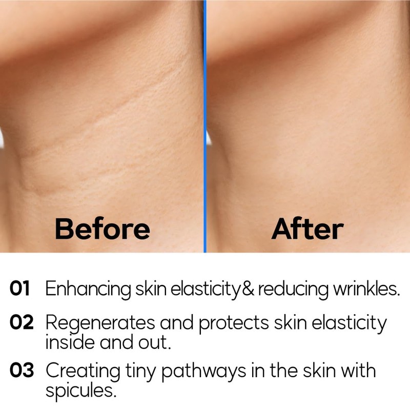 PONGDANG professional Concentrate Spicule Cream