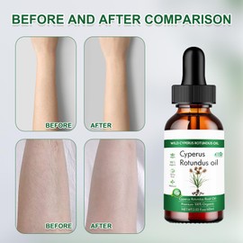 Cyperus Rotundus Cyperus Oil Cyperus Rotundus Oil Cyperus Rotundus Oil Cyperus Rotundus Oil Cyperus Oil Cyperus Rotundus Oil Cyperus Rotundus Cyperus Rotundus Oil Cyperus Rotundus Oil Cyperus Oil