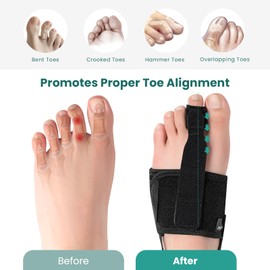 Welnove Hammer Toe Straightener - Toe Corrector for Women & Men - Toe Splints for Straightening Curled, Crooked, Claw, Hammer Toes - Broken Toe Support (2 Compression Foot Wrap & 2 Toe Straps)